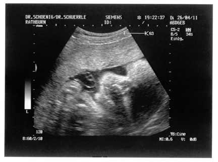 Ultrasound 26April2011b